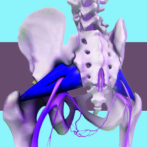 Botox for piriformis pain