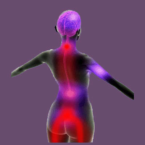 Fibromyalgia and piriformis syndrome