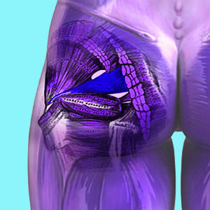 Home Remedy for Piriformis