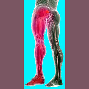 Piriformis Leg Pain - Piriformis Pain