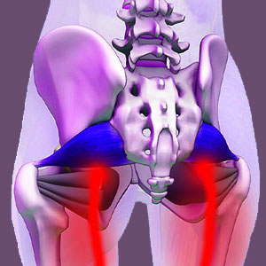 Piriformis Muscle Imbalance