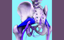 piriformis pain