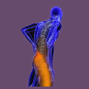 Piriformis Pain Standing