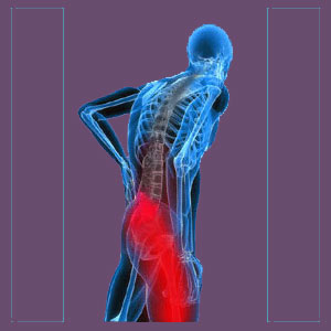 Piriformis Syndrome Right Leg