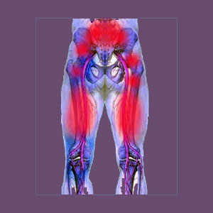 piriformis syndrome test