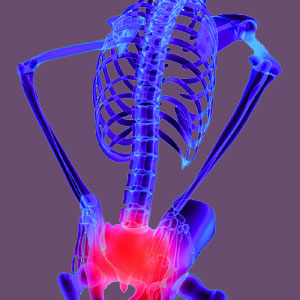 Psychosomatic Piriformis Pain