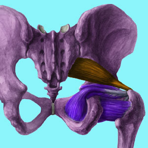 What is Piriformis Syndrome?